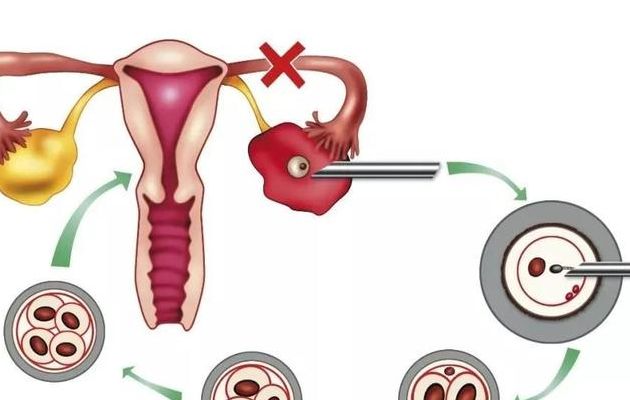 设计婴儿和试管婴儿的区别:前者挑基因,后者帮怀孕