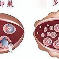 如果不排卵能做试管吗？常规促排与卵子体外成熟利弊PK