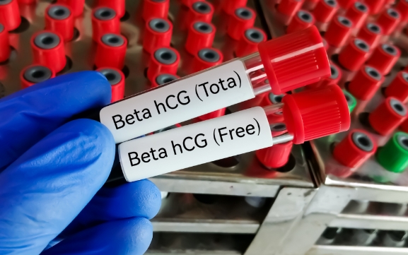 血HCG正常值对照表详解：从基础到临床实用指南