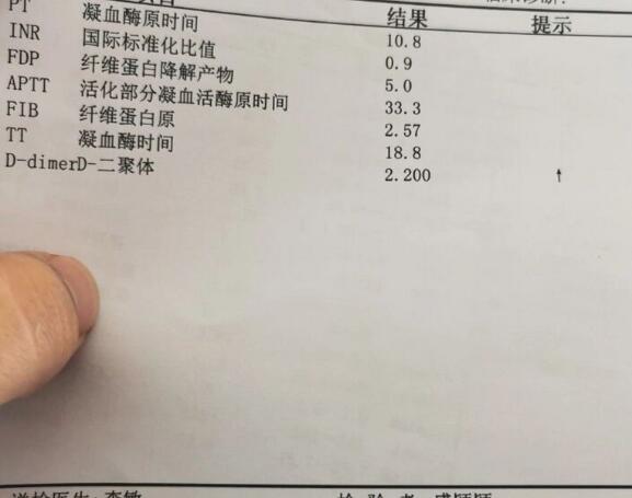 试管移植30周后D二聚体变高是正常孕期变化吗？