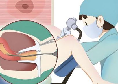 如何让女生怀孕生孩子呢？先做对这3步再备孕