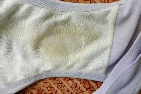 女性通过看内裤不能知道自己怀没怀孕