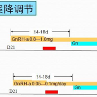试管改良长方案流程及成功率