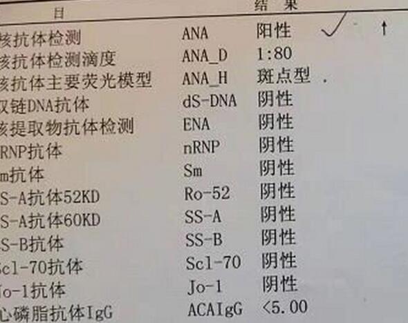 该抗体异常会影响胚胎着床