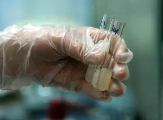 hiv携带者去美国洗精做试管大概需要多少钱？