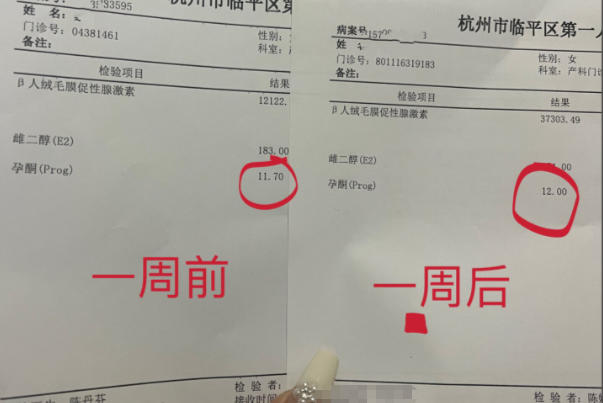 孕酮只有9.8有保胎成功的希望吗?揭秘继续妊娠的关键因素
