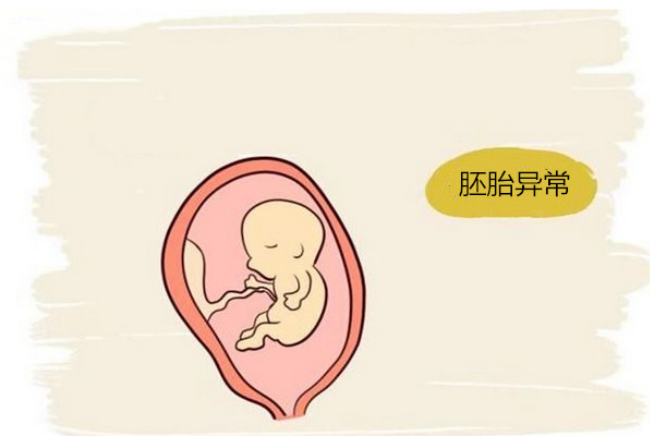 胚胎异常