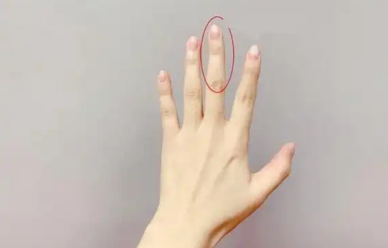 100种皮肤病对照表