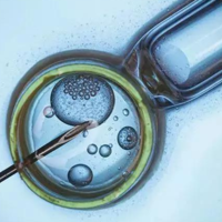 单身能做试管婴儿吗？全面解析与建议