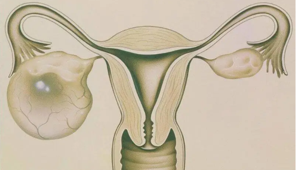 产后卵巢囊肿大小范围