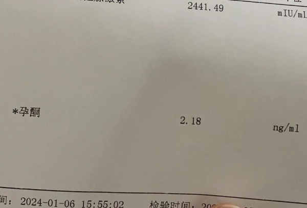 孕酮低于15不一定需要保胎