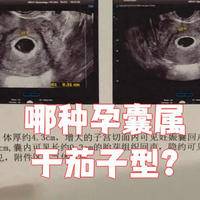 茄子状孕囊b超图是什么样子，长径与短径比例有显著差异