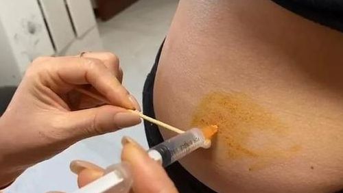 昆明送子鸟不孕医院正规吗？过来人梳理试管多少钱与6笔费用价格明细
