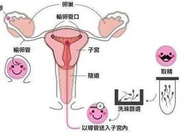 上海私人医院试管单女性可以做试管吗？先弄清这几点再决定