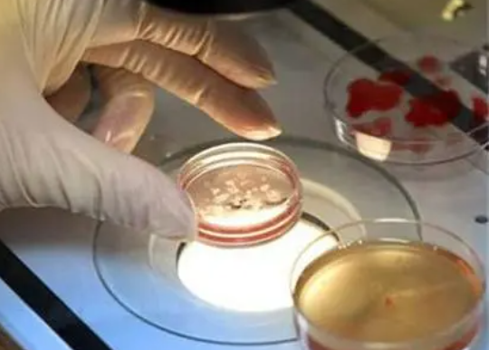 在曼谷做试管婴儿生的宝宝可以入泰国籍吗？