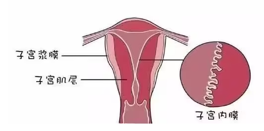 子宫内膜增厚刮宫.png