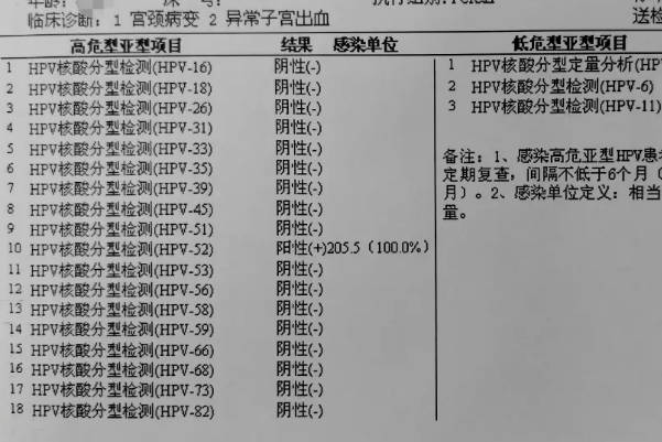 hpv正常值是阴性的结果