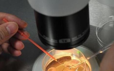 试管婴儿怀龙凤的几率有多大？5个判断维度讲清关键因素