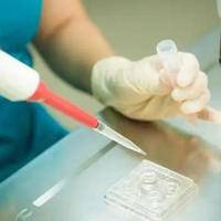 鲜胚移植男孩几率大吗?一文揭开胚胎性别的科学面纱