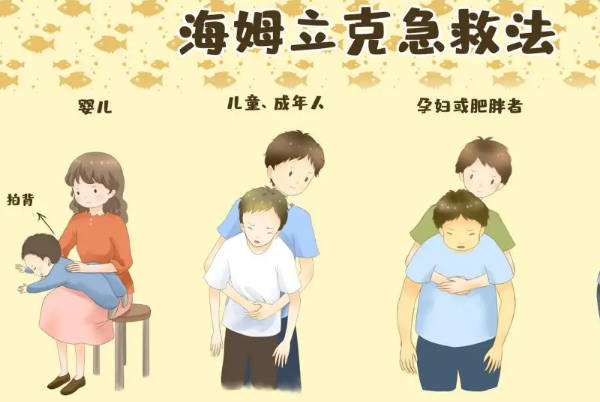 海姆立克急救法需要冲击上腹部
