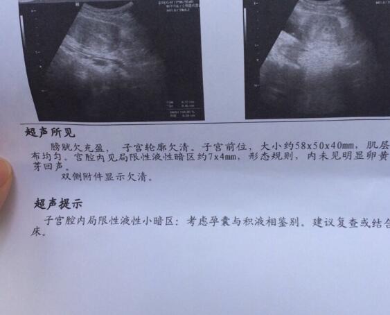 胚胎着床会出现液性暗区