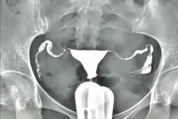 地域会影响4D无痛输卵管造影的价格