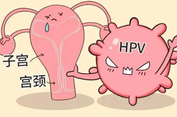 hpv检查一般不是很尴尬
