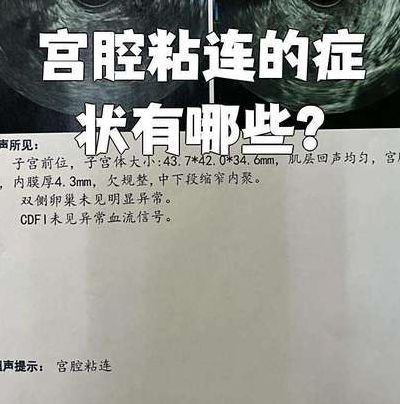 宫腔粘连分离后多久可以怀孕？别只看日历，关键看这三个信号