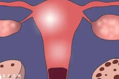 多囊做试管婴儿需要多少费用？过来人帮你梳理5笔开销明细