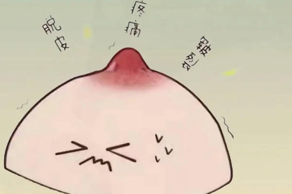 乳头颜色变深是生男宝宝的症状