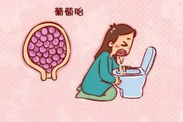 只要怀过葡萄胎的人就一定就不吉利吗？