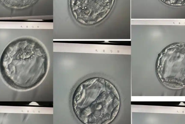 4cb囊胚质量不是优质胚胎