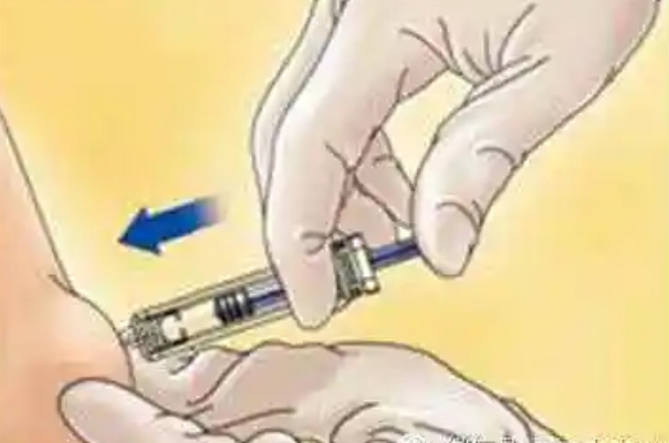 依诺肝素钠腹部注射更稳定
