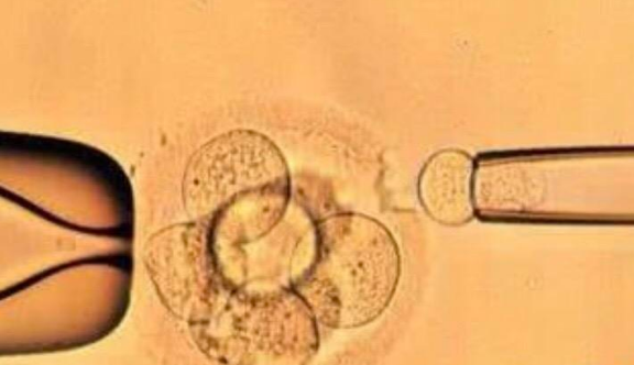 精子质量是胚胎培养的关键之一