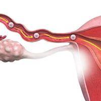 输卵管通而不畅怀孕几率多高?医疗干预与生活调理