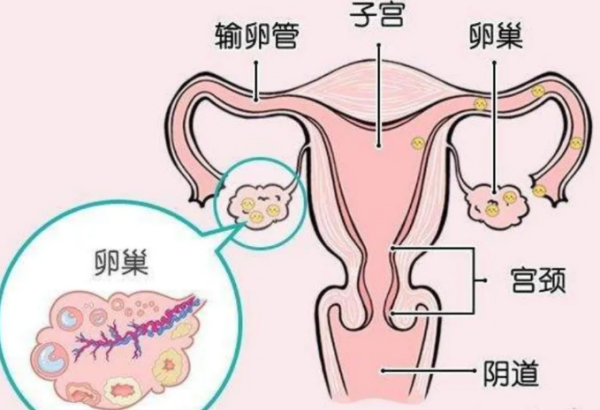 输卵管阻塞会影响怀孕吗