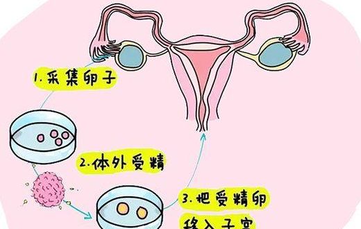 不孕不育还能做试管吗？过来人帮你梳理多少钱和5笔开销价格明细