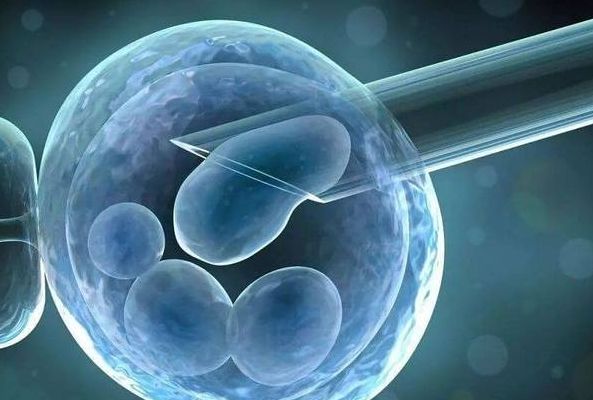 格鲁吉亚医院做试管婴儿多少钱？过来人帮你梳理5笔开销明细