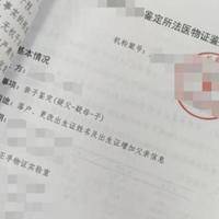 自己做亲子鉴定最简单方法，常见的有头发样本和口腔拭子