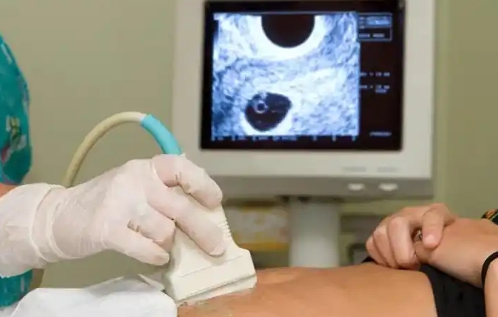 男孩胎心率的正常范围 男孩胎心率的正常范围