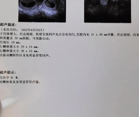 得过子宫内膜结核做试管成功例子，我38岁一次成了