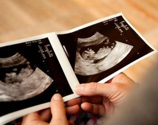 37周胎儿偏大原因有多种