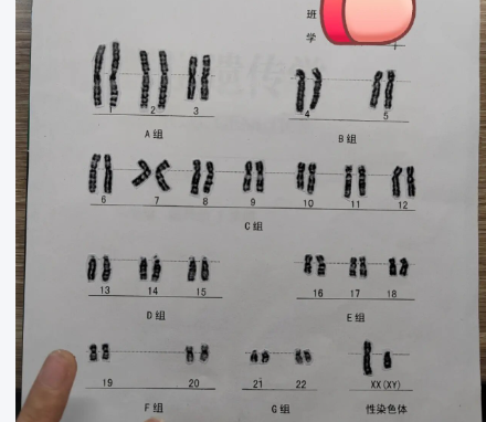染色<a href=