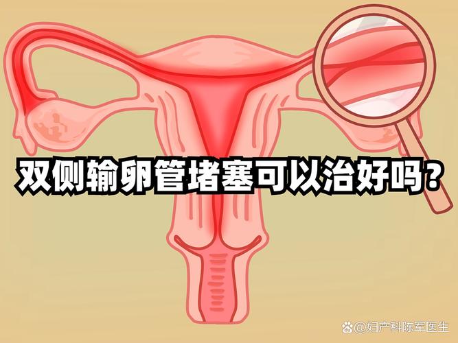备孕两年没动静，一查双侧输卵管都堵了，我直接去做了试管