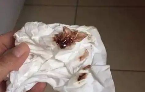 孕期出现咖色分泌物