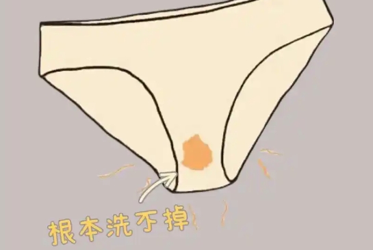 孕晚期内裤总是湿漉漉