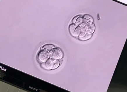 有生下囊胚4bc的宝宝吗.png