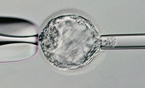 囊胚活检的具体步骤