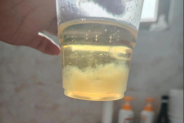 酒精和尿不能测出男女