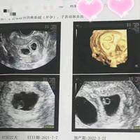 三代试管婴儿一超后稳定了吗？可能面临还要多重挑战